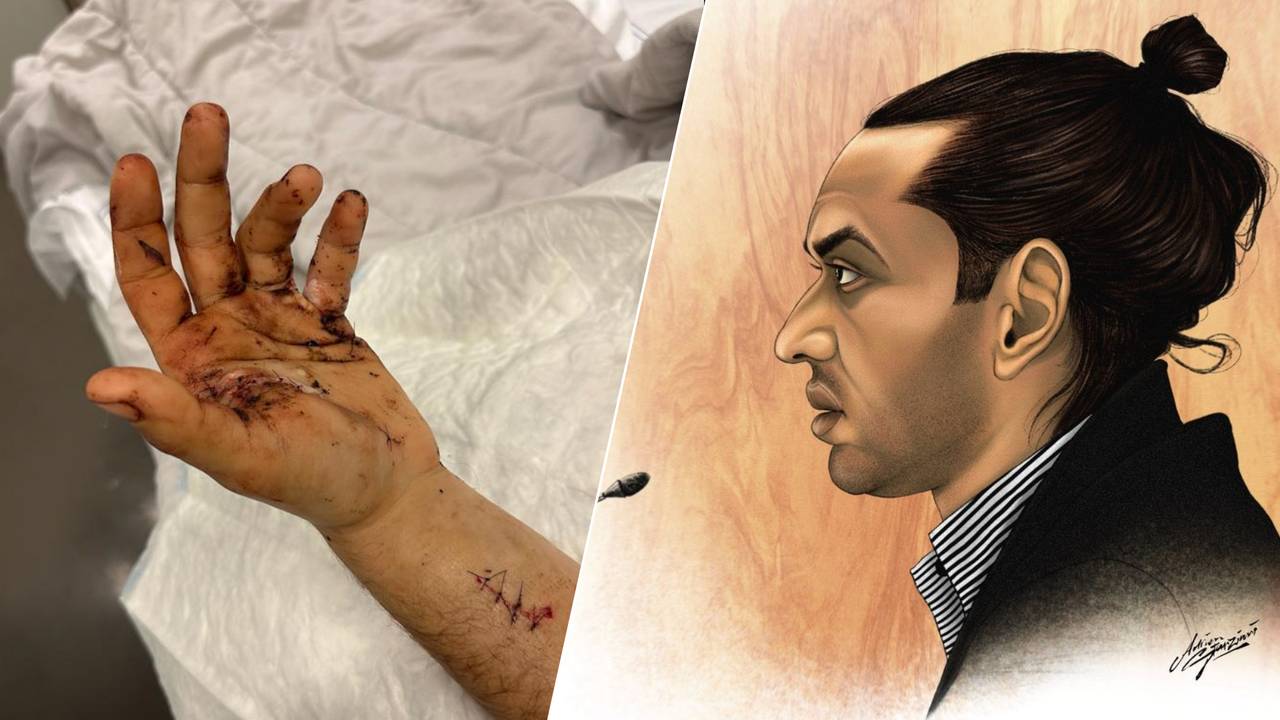 Links de verwondingen van Sem, rechts Raymond S.