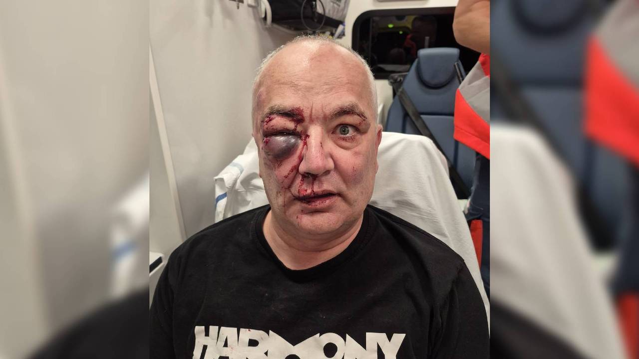 Jan in de ambulance na de mishandeling (eigen foto).