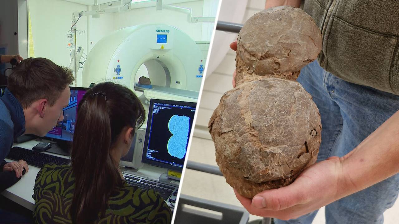 Remains of a baby dino have been discovered in a 70-million-year-old egg with hospital x-rays