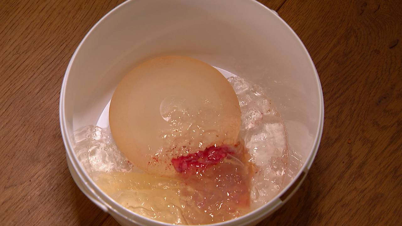 Zo zagen de siliconen van Tara er na de verwijdering uit. 