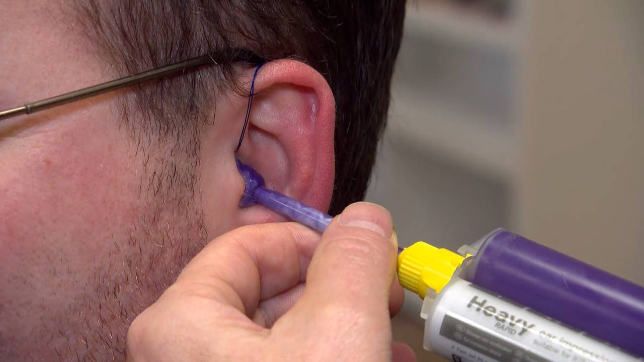 Het aanmeten van oordopjes.