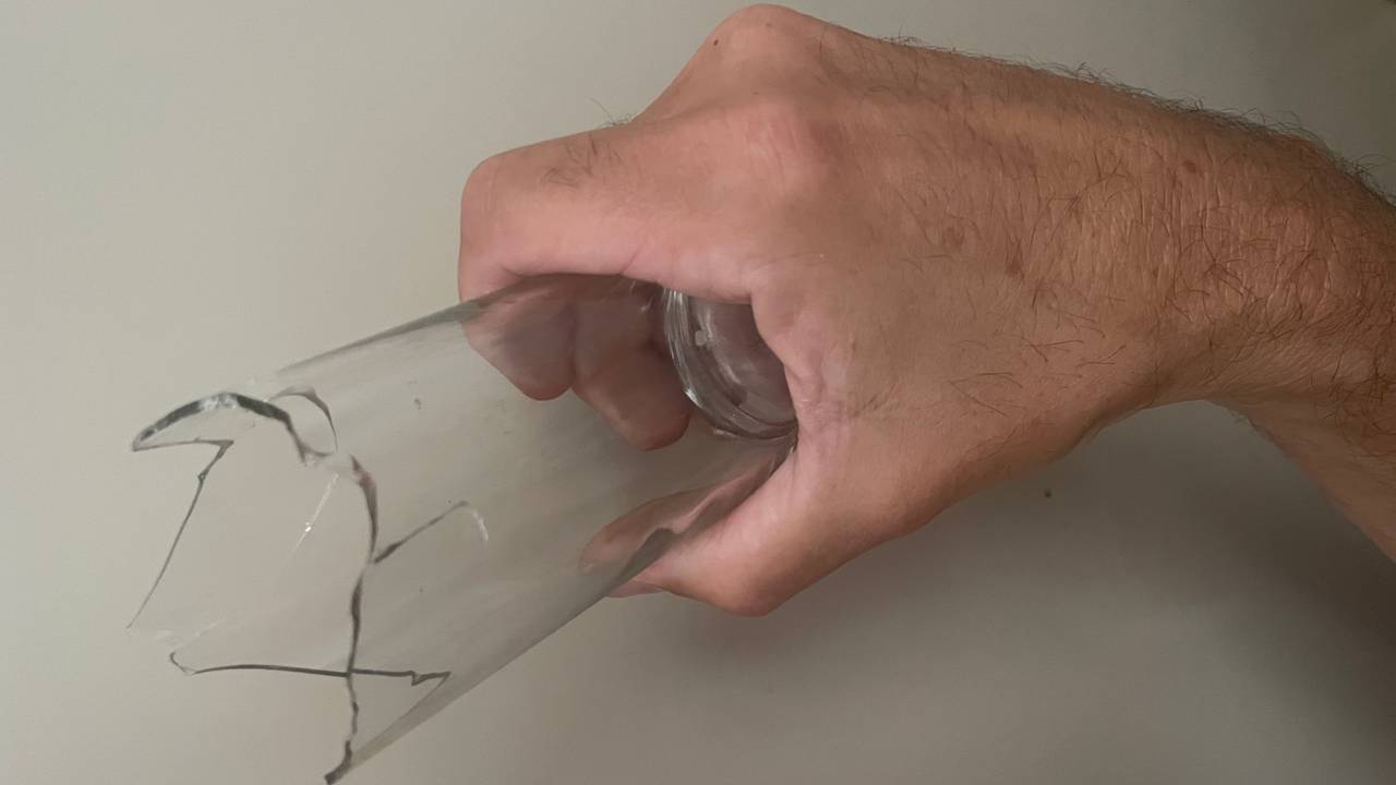 Een man is verminkt aan zijn oog door een glas in het gezicht (foto: Hans Janssen).