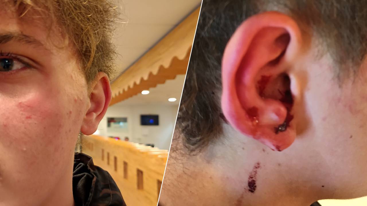 Jesse liep een gescheurd oor en een flinke hersenschudding op (eigen foto).