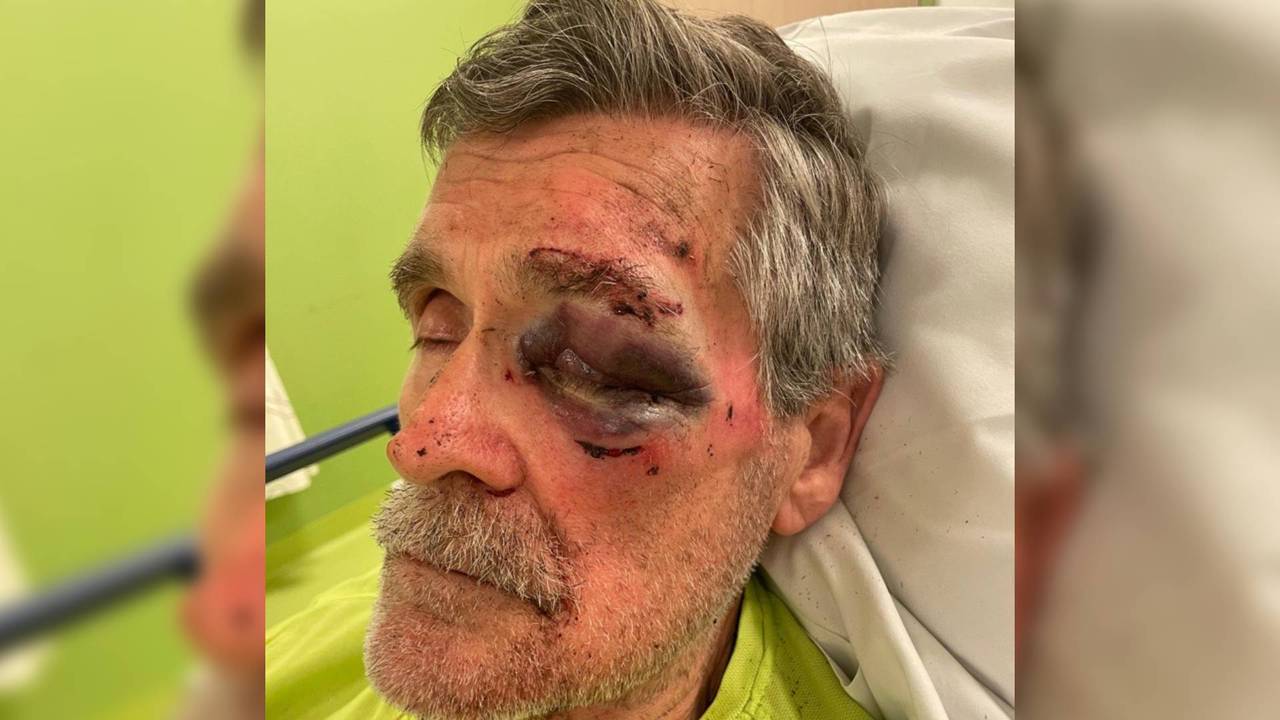 Wim in het ziekenhuis na de mishandeling (foto: Werner Brul)