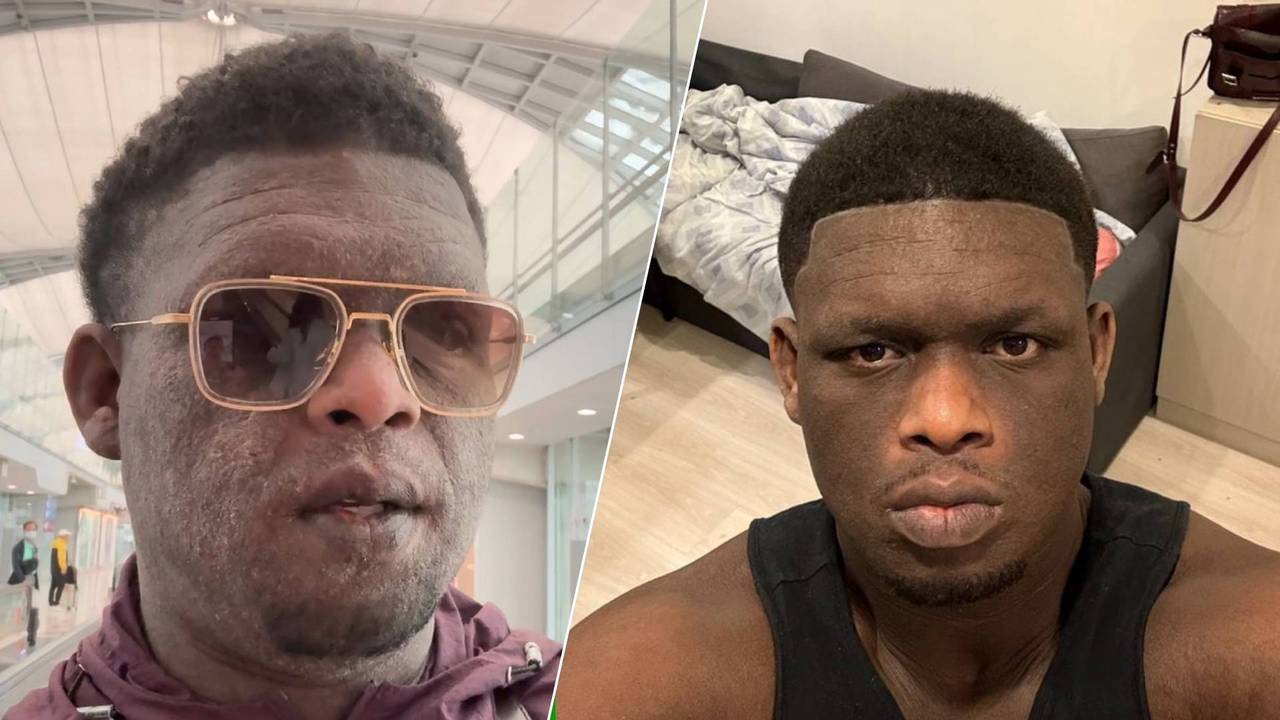 Anneudy bij aankomst in Bangkok en na enkele behandelingen (eigen foto).