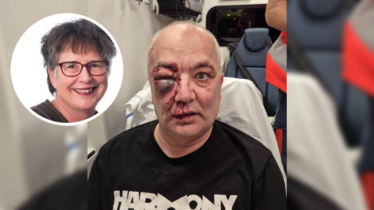 Links: Elise Merlijn Rechts: Jan na de mishandeling in de ambulance (Foto: FNV / Eigen foto.)