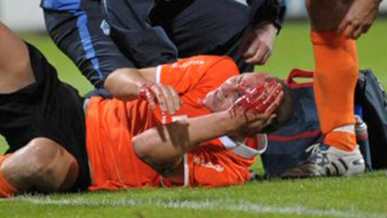 John Verhoek liep een hoofdwond op (foto: Henk van Esch)