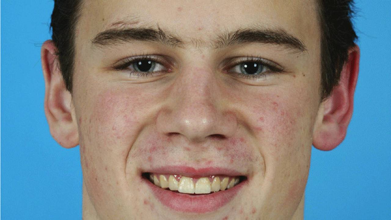 Van der Zanden haalde eerder wel de vlinderfinale (foto: ANP).