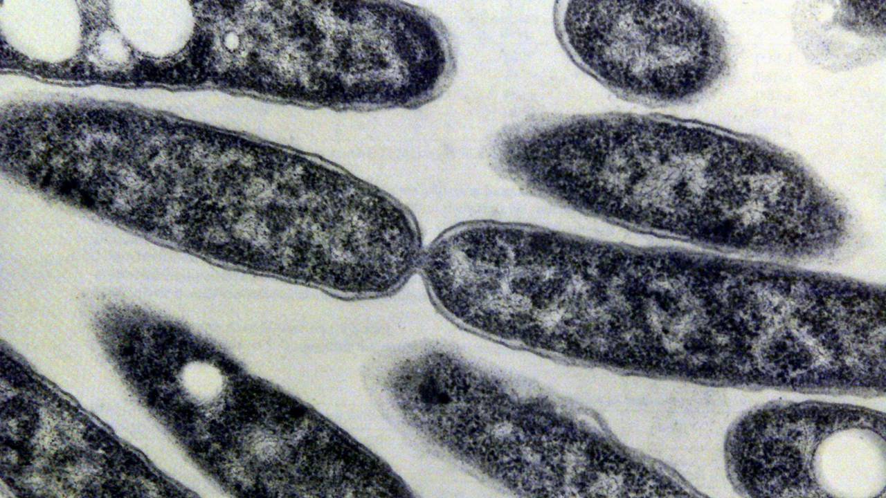 Legionelabacterie. Foto: ANP