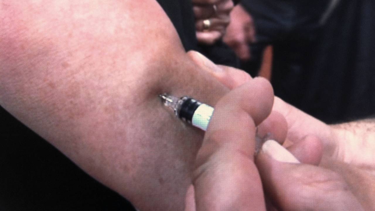 Mazelenepidemie breidt zich uit