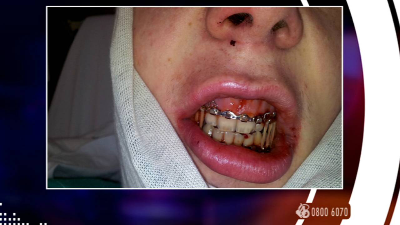 Ga naar slide 2