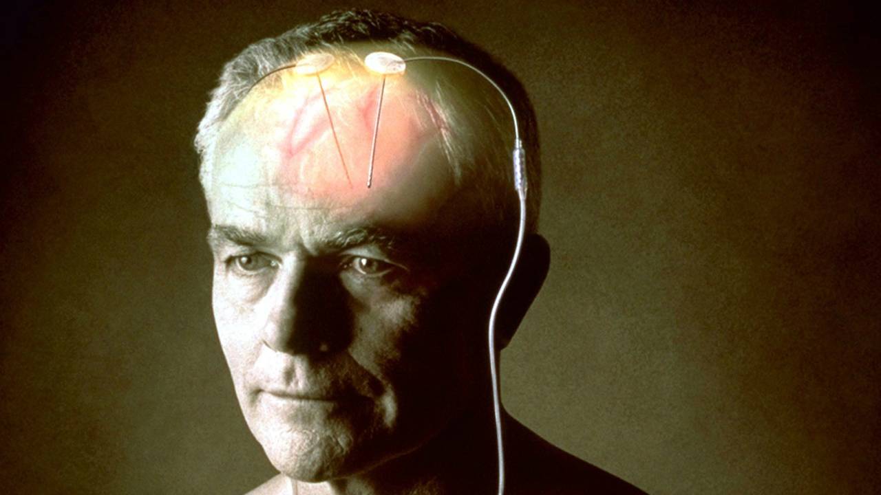 DBS-therapie van Medtronic bij patient