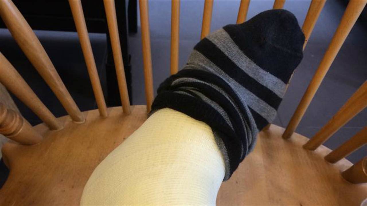 Nol Havens zit zes weken in het gips