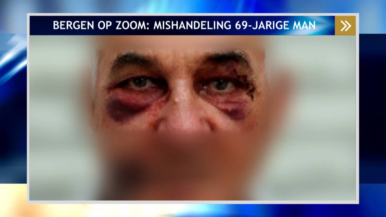 Johan Koolen werd zwaar mishandeld