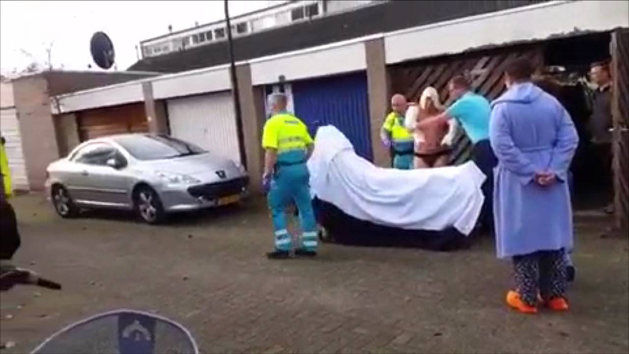 Edwin K. met brandwonden aan hoofd en armen
