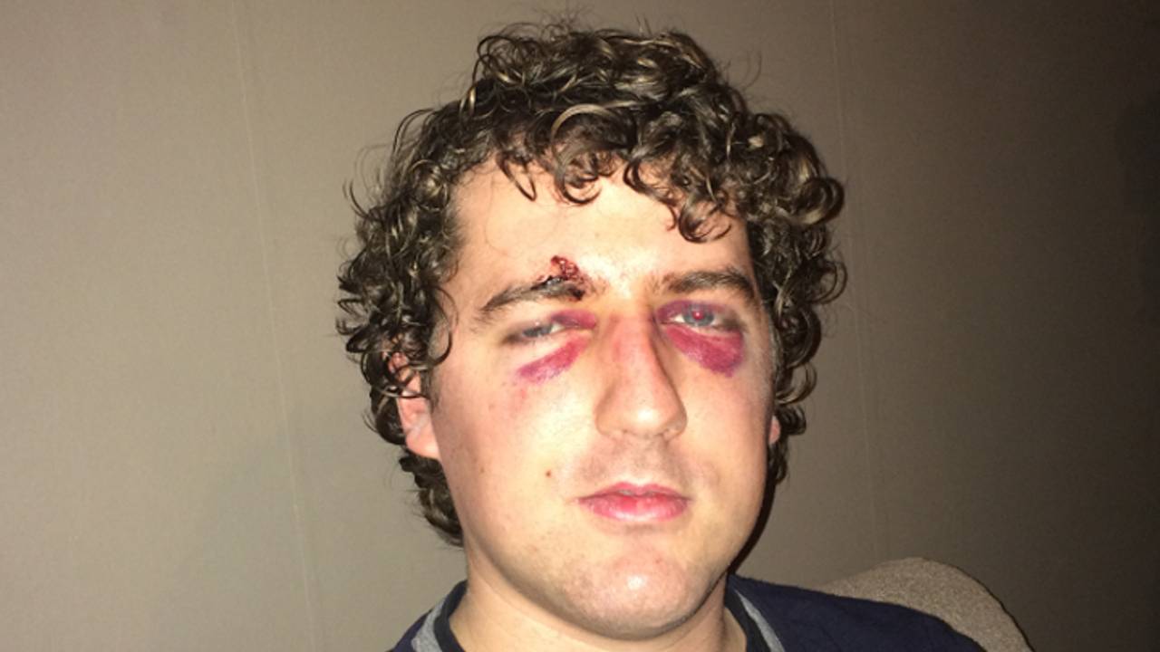 Bram Klemann flink mishandeld (foto: Bram Klemann)