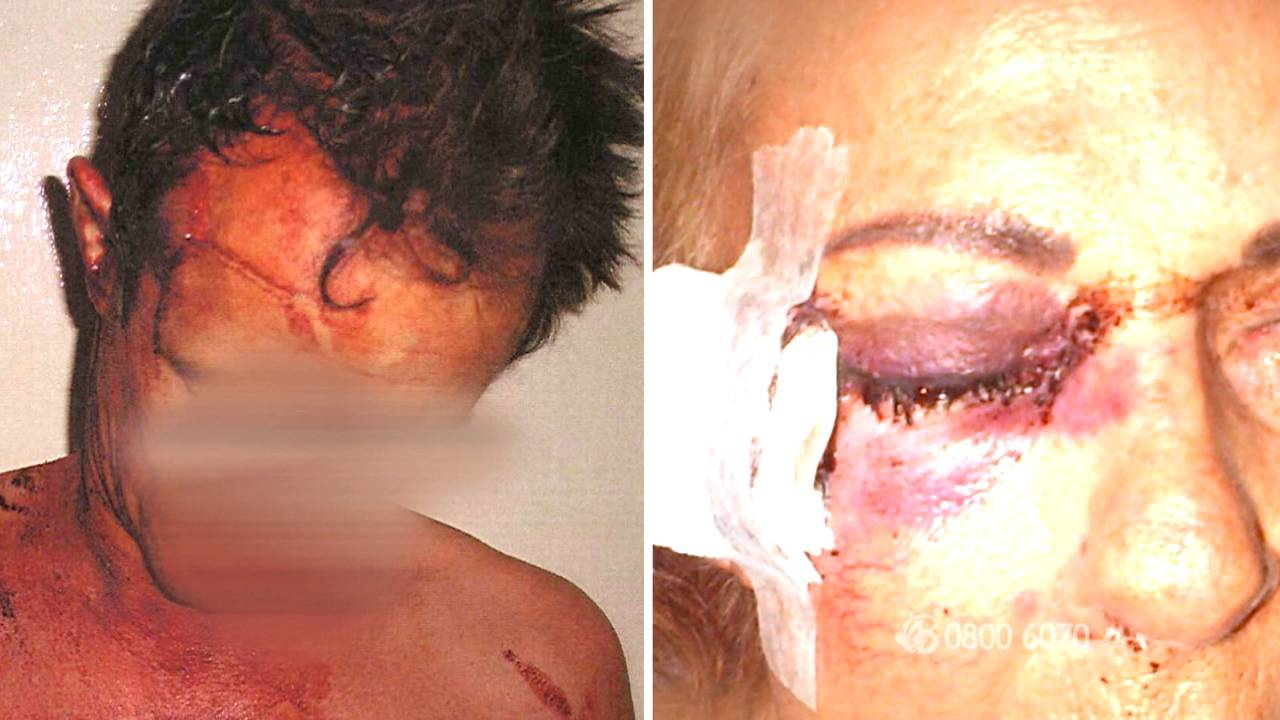 De man en vrouw werden zwaar mishandeld bij de overval. (Beeld: Bureau Brabant)