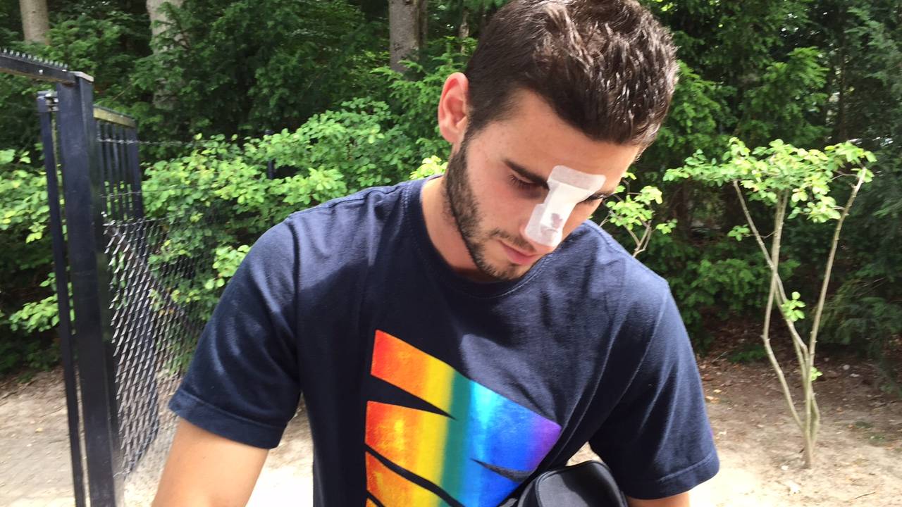 PSV-nieuweling Gastón Pereiro heeft zijn neus gebroken. (foto: Paul Post)