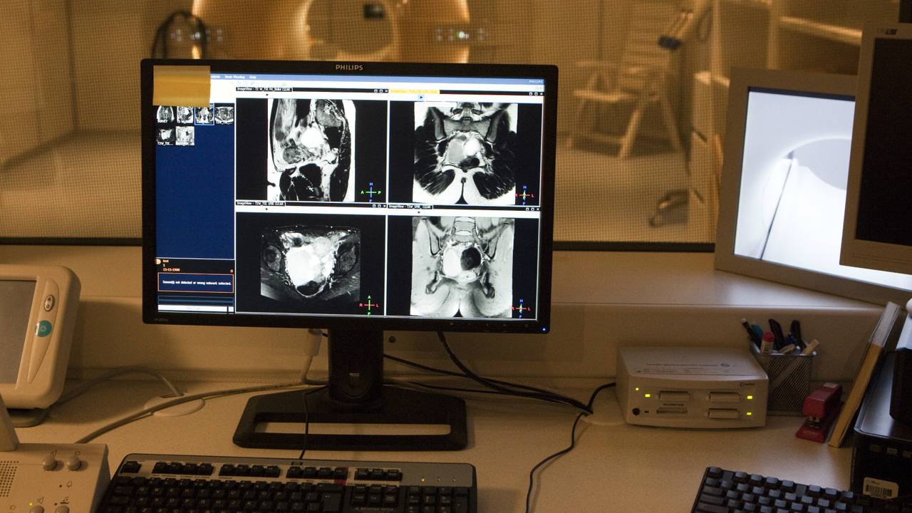 Een mri-scanner met beelden die worden uitgewisseld. (foto: Máxima Medisch Centrum)