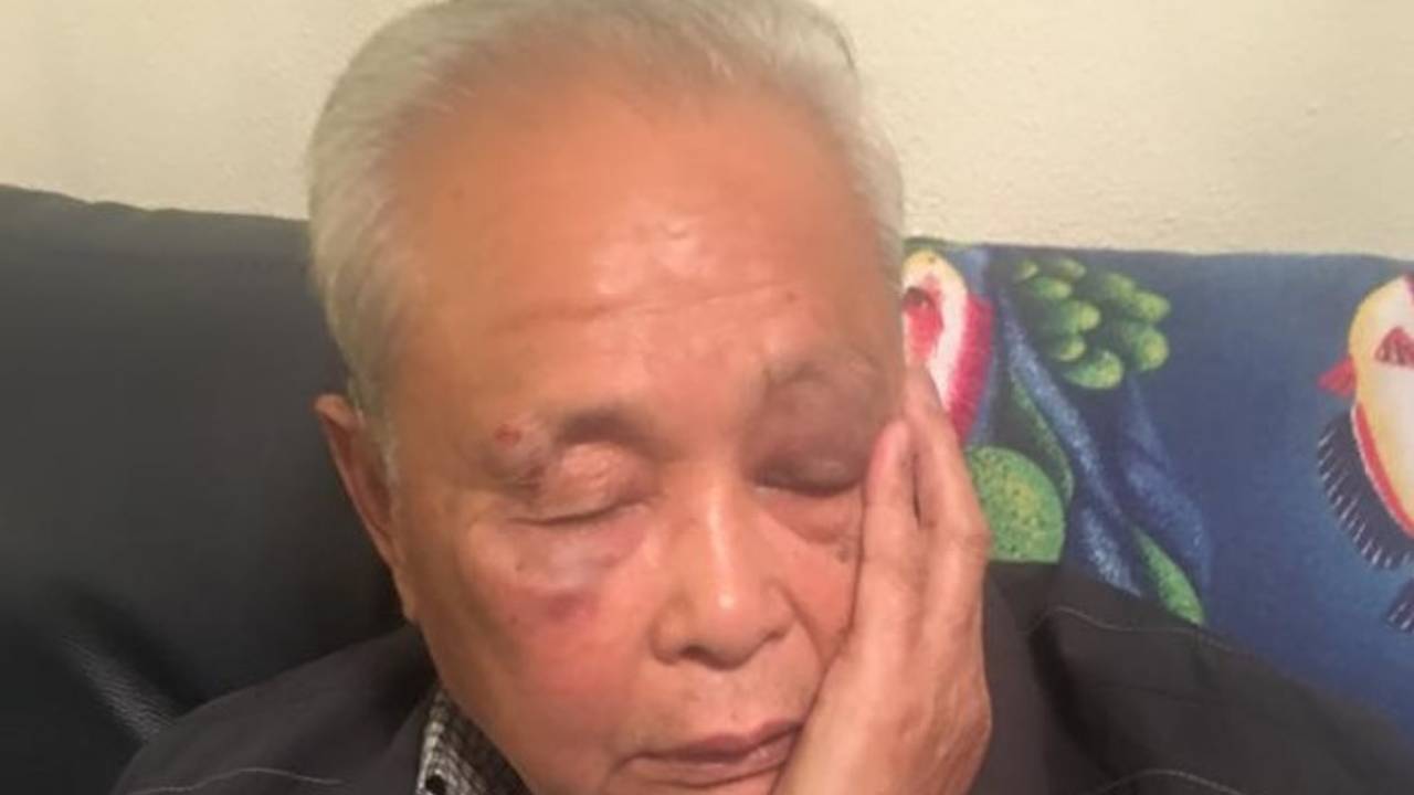 De vader had een blauw oog en last van zijn voortanden. Foto: Facebook