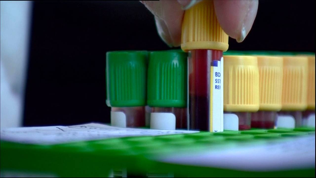 Q-koorts onderzoek (archieffoto)