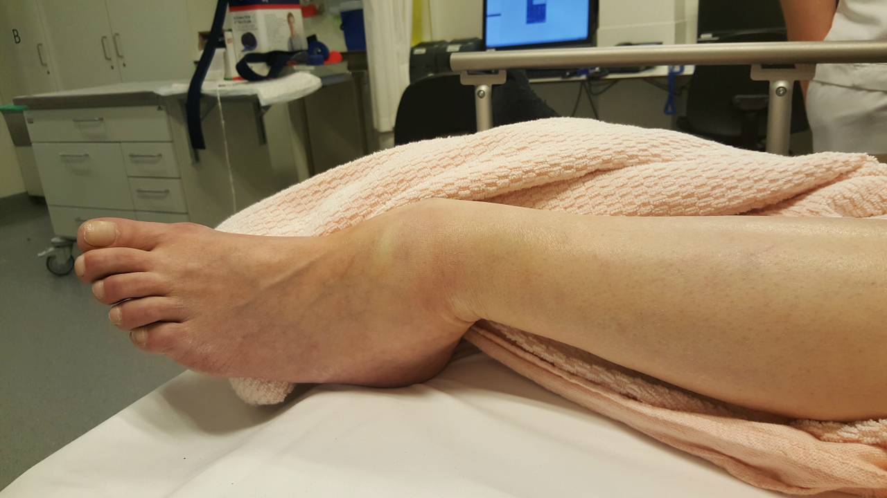 Ga naar slide 1