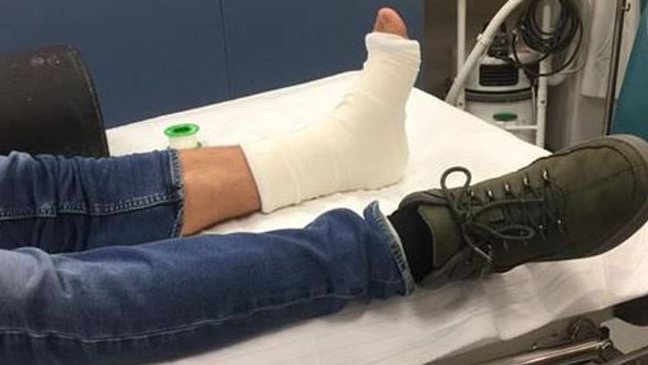 De zoon van Vanessa met een zwaar gekneusde voet (foto: Vanessa Martens).