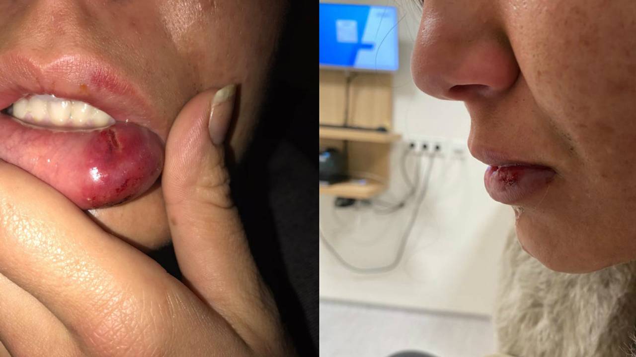 Daphne liep meerdere verwondingen op (foto: Daphne)