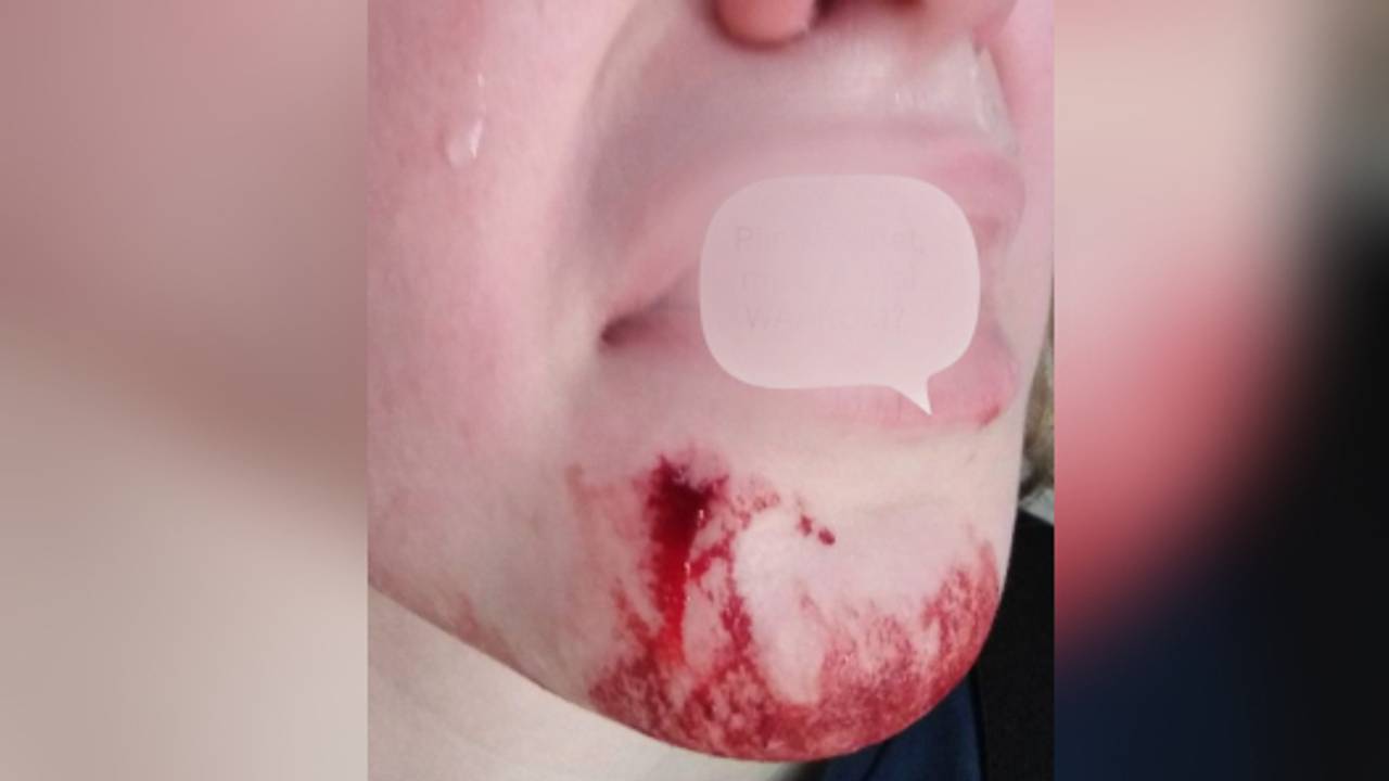 Patricia's zoontje moest naar de eerste hulp (foto: Patricia van den Heuvel / Facebook).