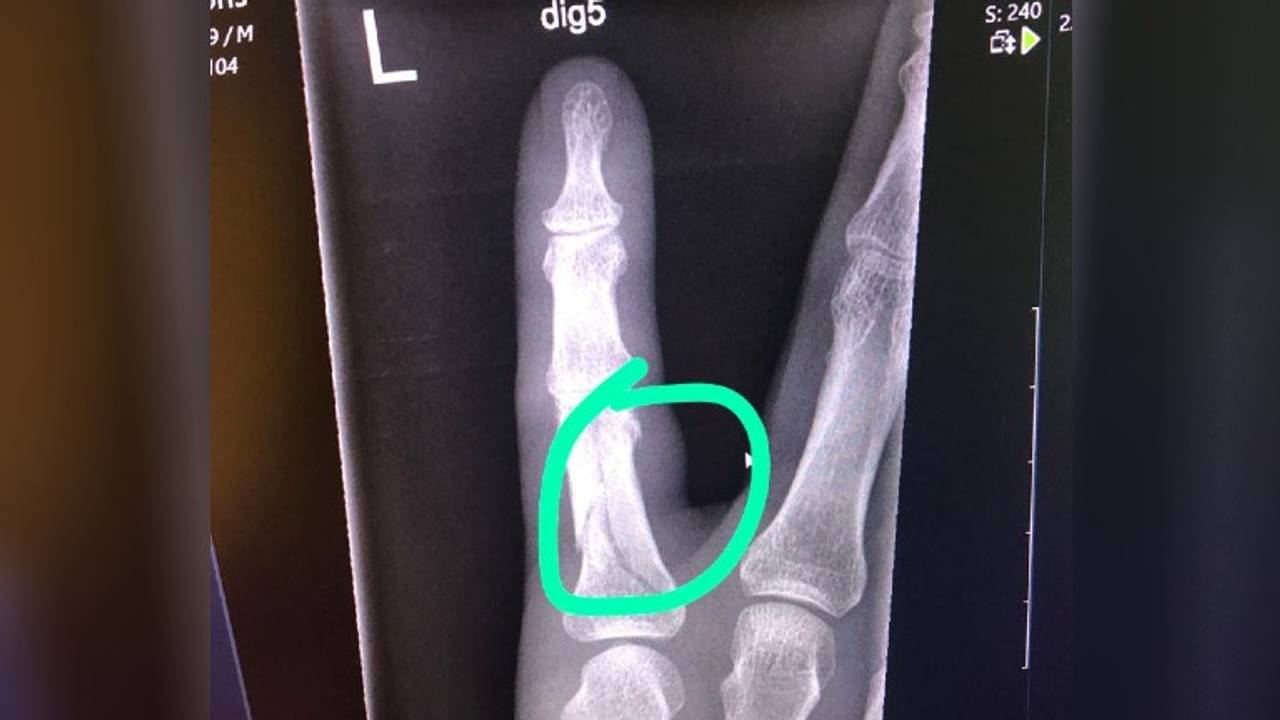 Foto: Joris van Duin