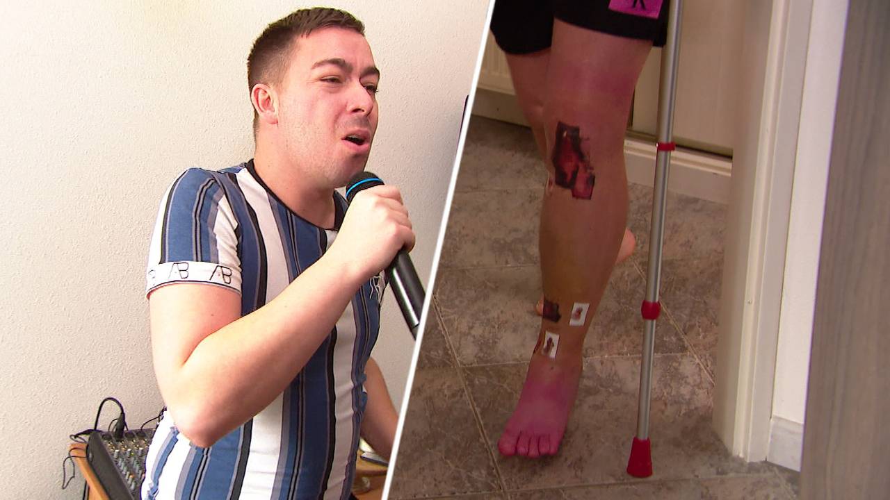 Toreador Pigmans breekt been, maar staat deze carnaval gewoon op het podium