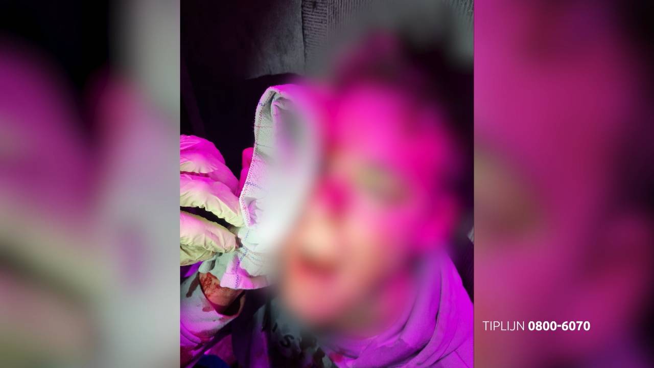 Het slachtoffer na de mishandeling (foto: Bureau Brabant).