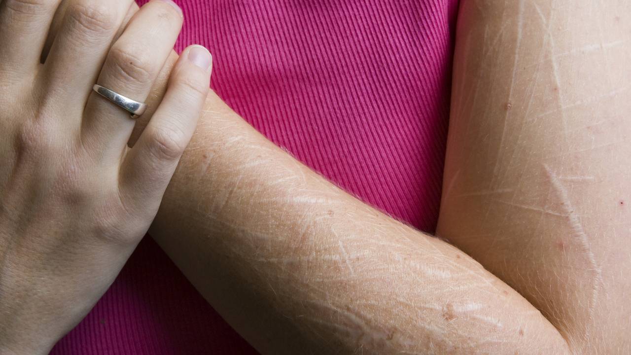 Een foto van zelfbeschadiging (dit is niet ...). Foto: ANP.