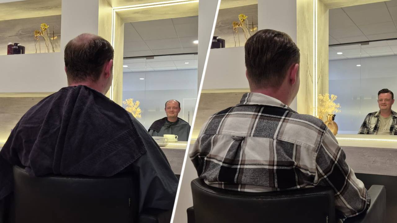 Wilco Zonneveld (27) draagt al sinds jonge leeftijd een toupet (foto: Niek de Bruijn)