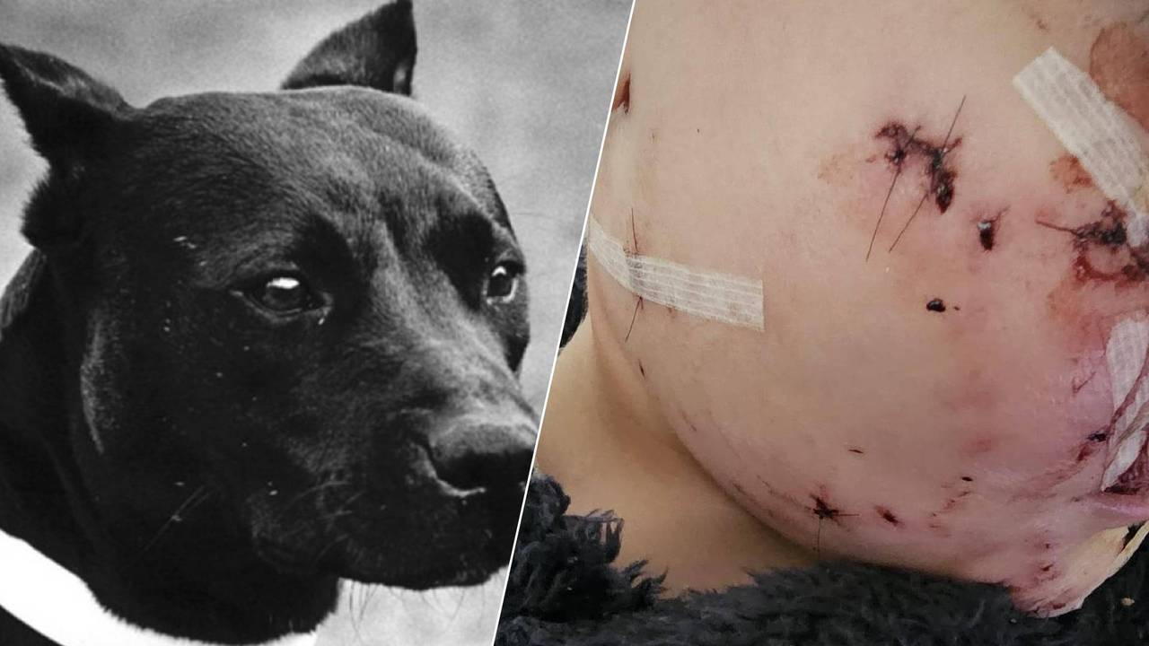 Een pitbull ter illustratie, dit is niet de hond die Ayman beet (foto: Archief/Ismail Rifi).