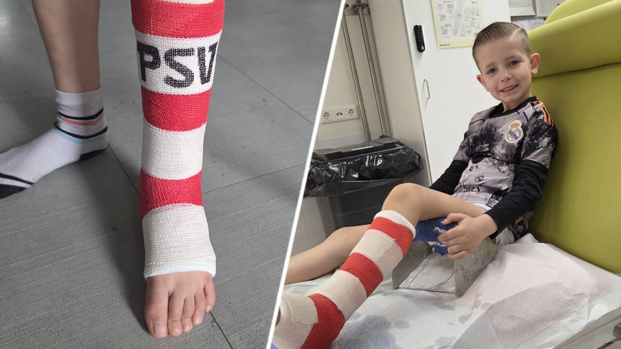 Jaivey met z'n PSV-gips (privéfoto's).
