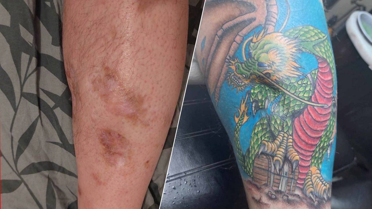 Het been van Rob voor en na de tattoo (foto's: Rob Matthijssen).