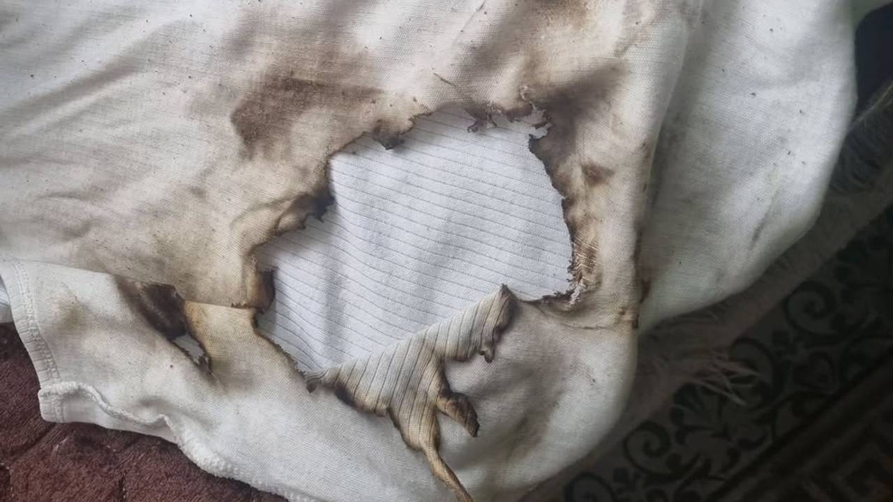 Het jongetje liep ernstige brandwonden op (foto: Politie Best en Oirschot).