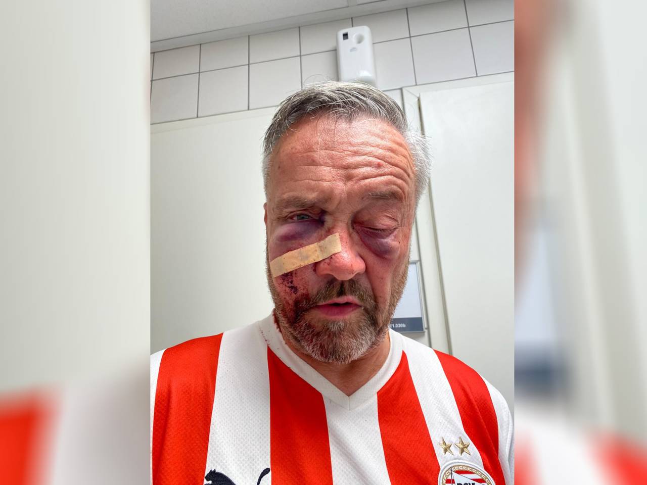 Anthony van der Vloet, kort nadat hij was toegetakeld (eigen foto).