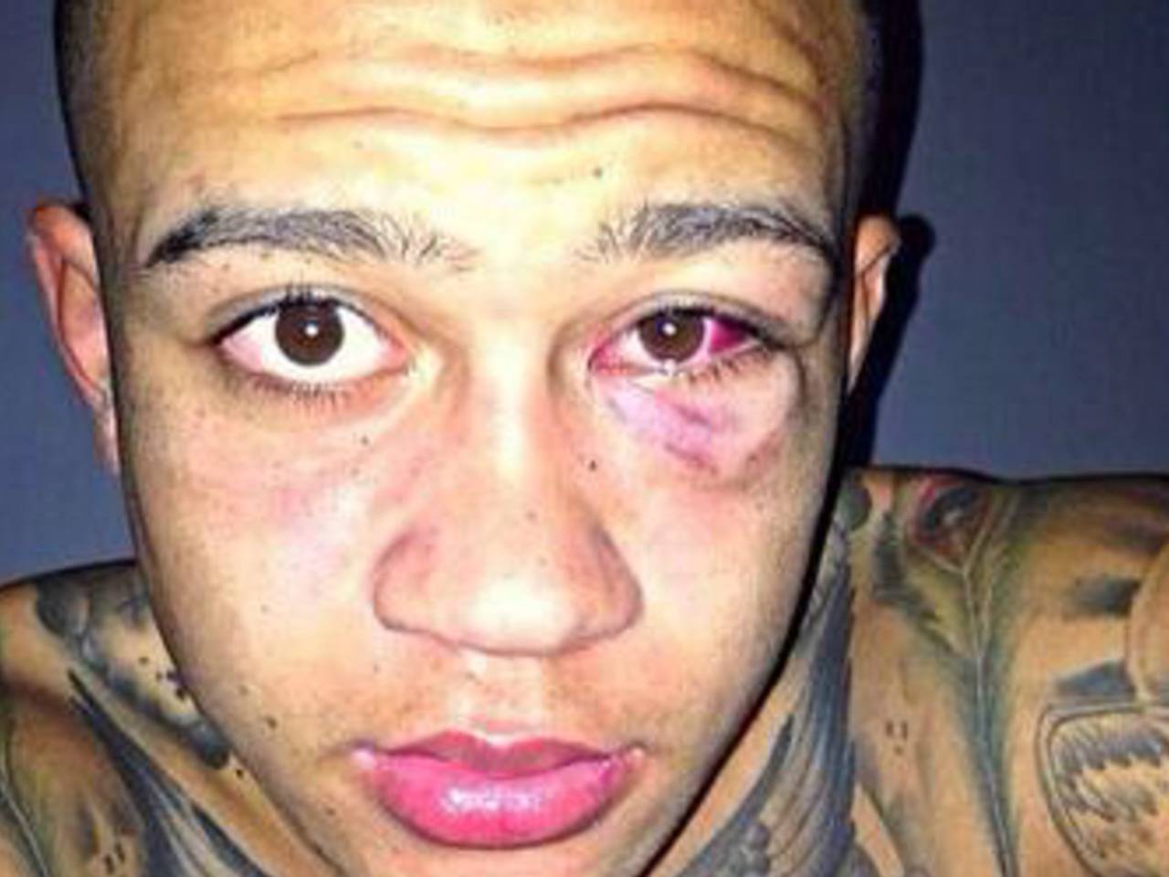 Blessure van Depay (Foto: Twitter)