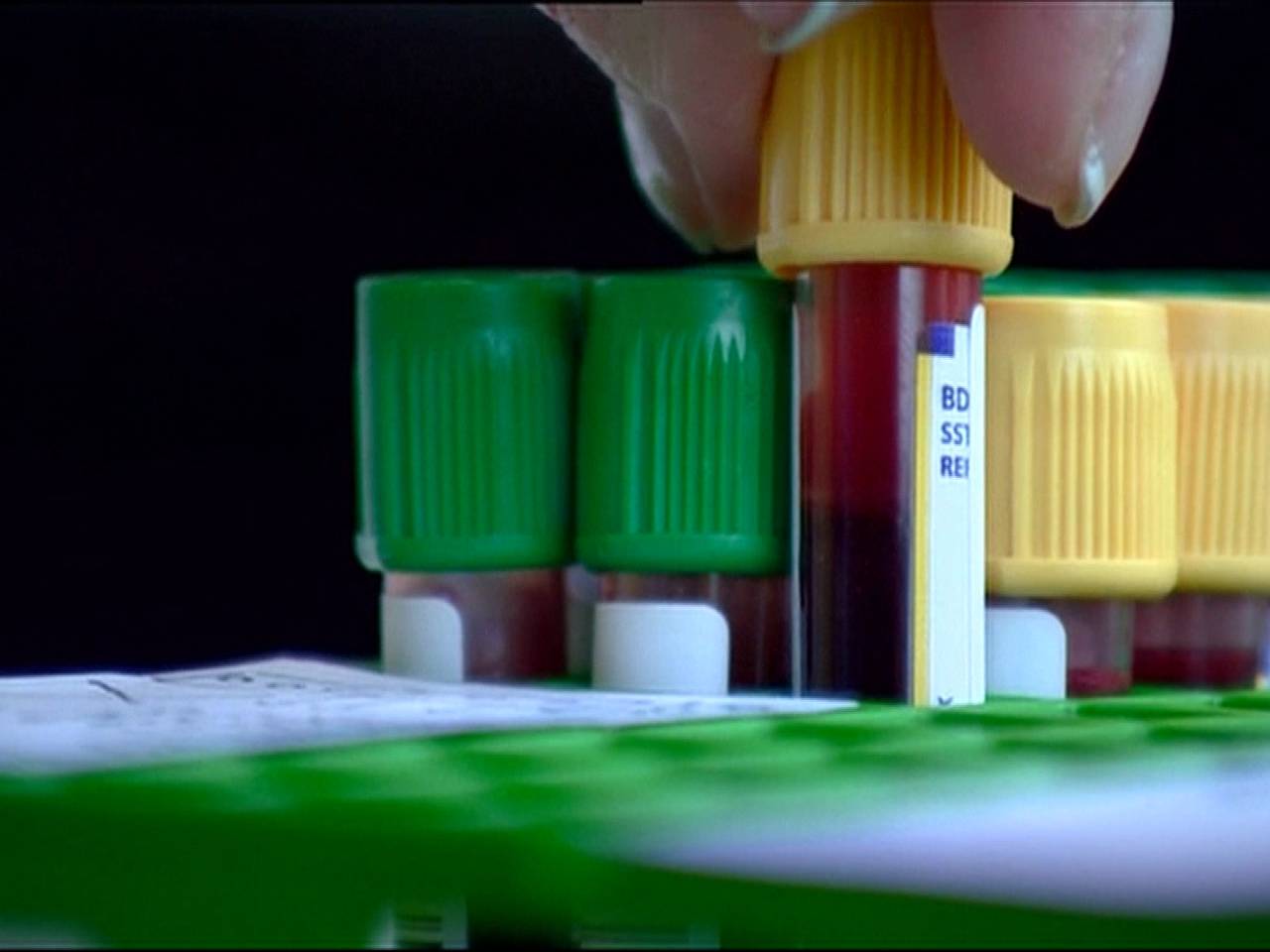 Q-koorts onderzoek (archieffoto)