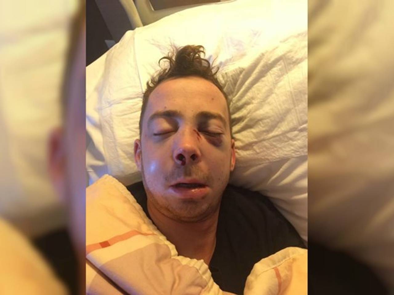 Niels na de mishandeling.