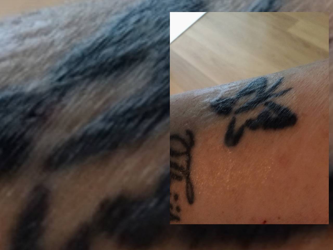 Anne moet de tatoeage van haar overleden zoontje laten verwijderen.