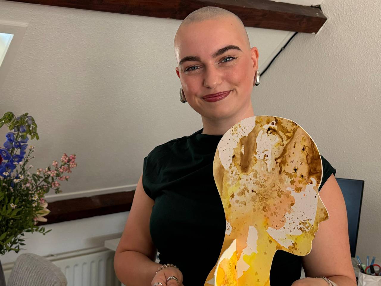 Anne is al sinds haar vijftiende kaal en zet zich nu in voor mensen met alopecia.