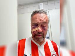 Anthony van der Vloet, kort nadat hij was toegetakeld (eigen foto).