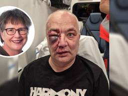 Links: Elise Merlijn Rechts: Jan na de mishandeling in de ambulance (Foto: FNV / Eigen foto.)