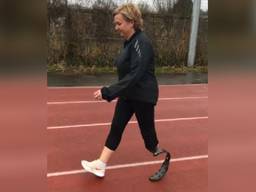 Dianne kan met haar sportprothese weer sporten 
