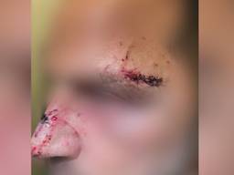 De man werd uit het niets met een glas in zijn gezicht geslagen (foto: Bureau Brabant).