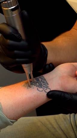 Spijt van tattoo