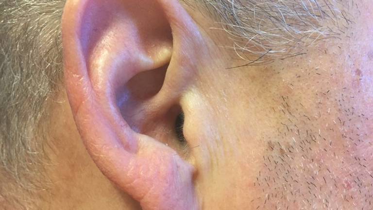 Agent heeft gehoorschade nadat vrouw hem toeschreeuwde